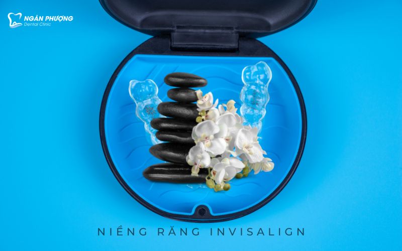 niềng răng Invisalign