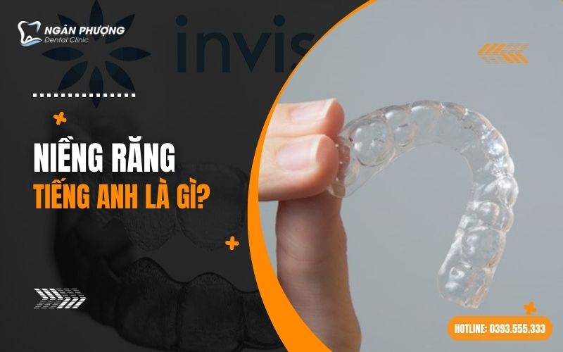 niềng răng tiếng Anh là gì