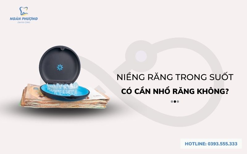 niềng răng trong suốt có cần nhổ răng không