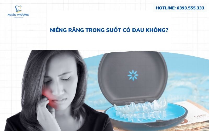 niêng răng trong suốt có đau không