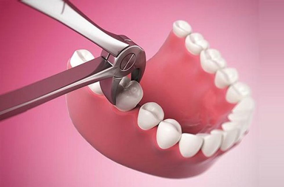 nieng rang co dau khong 5
