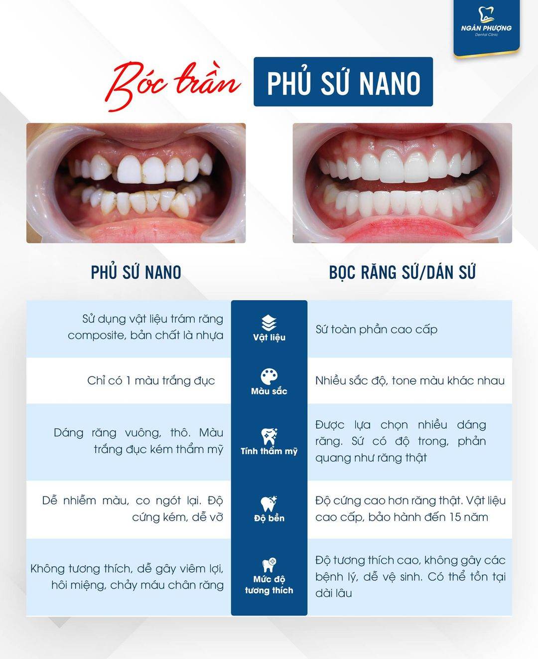 phu su nano 3