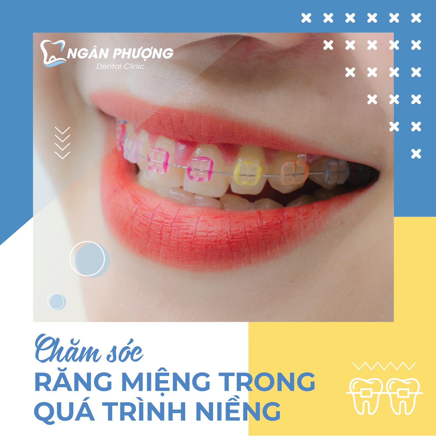 nieng rang tre em 8